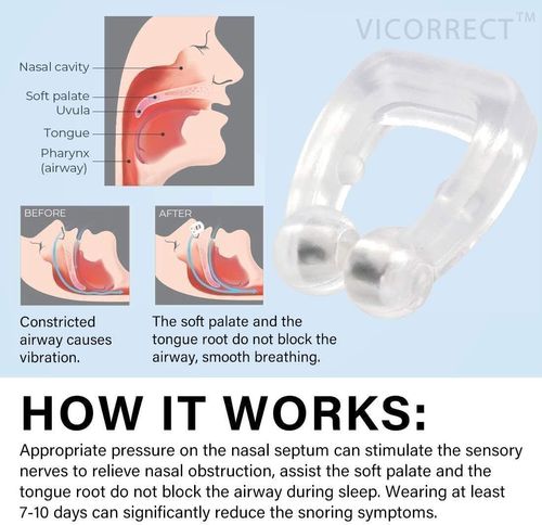 Anti Snore Magnetic Nose Clip Stop Snoring Device Sleeping Aid Nose Clip Relieve Snore for Men and Women Unisex (8 Clips)