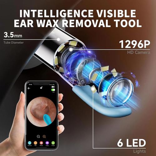Smart Illuminated Ear-Cleaning Tool with HD Endoscope