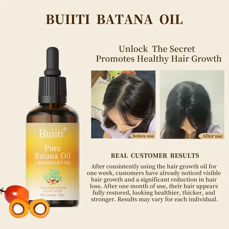 Buiiti Batana Oil with Rosemary for HairGrowth - Nourish Scalp & Detox forStrong &Healthy Hair, Organic BatanaOil with Rosemary -Reduce Hair Loss &Detox Your Scalp (30 mL) Haircare Rosemary Oil