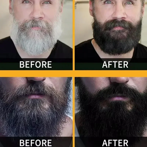 🔥Last Day  🔥 𝐏𝐨𝐥𝐲𝐠𝐨𝐧𝐮𝐦 𝐇𝐚𝐢𝐫 Darkening Soap