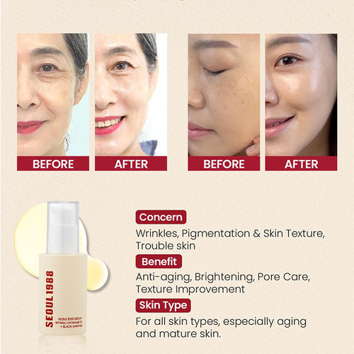 Retinol Essence Ginseng Facial Essence Closed Comedones Brightening Essence