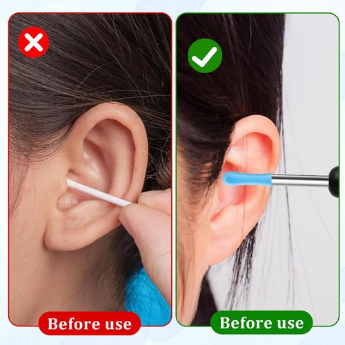 Smart Visual Ear Cleaner with Mini Camera