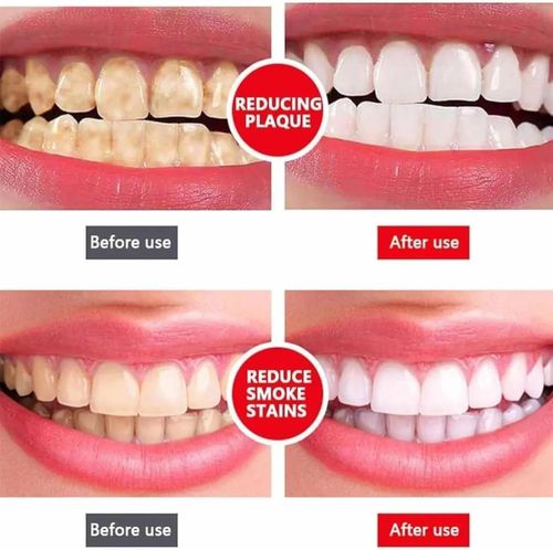 Yayashi SP4 Oral Care Probiotic Whitening Toothpaste 120g – Shine Brighter, Remove Years of Coffee, Tea & Smoking Stains