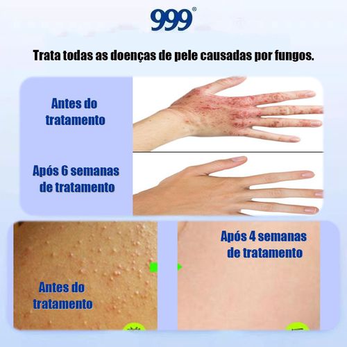 Pomada multiuso: bactericida, anti-coceira e refrescante Marca renomada e confiável Entrega em domicílio, pagamento na entrega