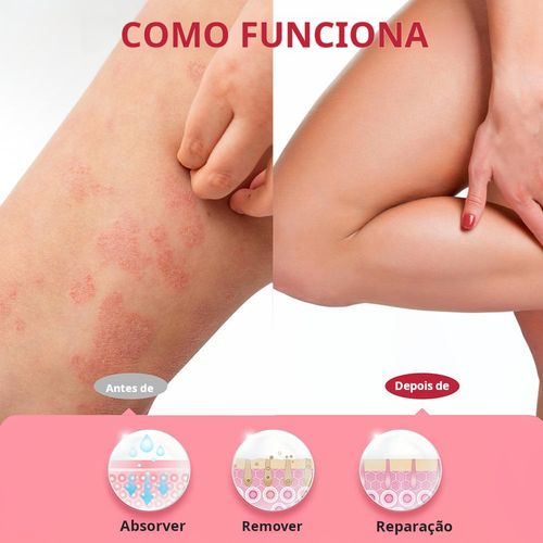 Trata doenças de pele, psoríase, dermatite e eczema. Pomada de ervas naturais. Entrega em domicílio, pagamento na entrega.