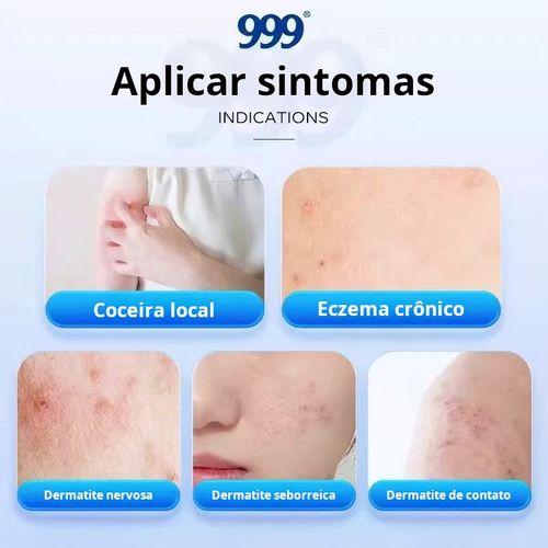 Pomada multiuso: bactericida, anti-coceira e refrescante Marca renomada e confiável Entrega em domicílio, pagamento na entrega