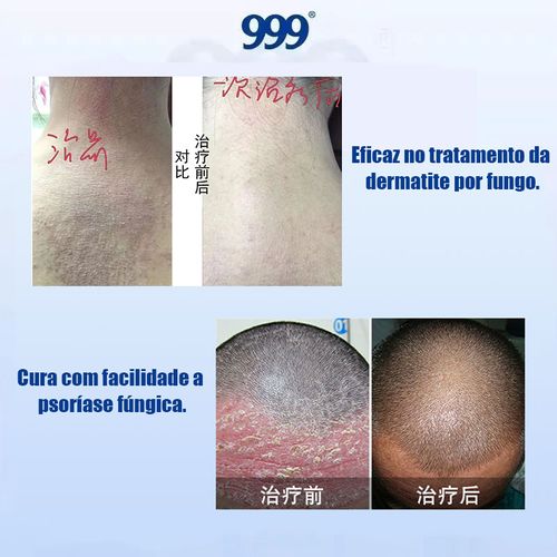 Pomada multiuso: bactericida, anti-coceira e refrescante Marca renomada e confiável Entrega em domicílio, pagamento na entrega