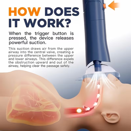 Home-Use Heimlich Anti-Choking Device with Throat Negative Pressure Suction