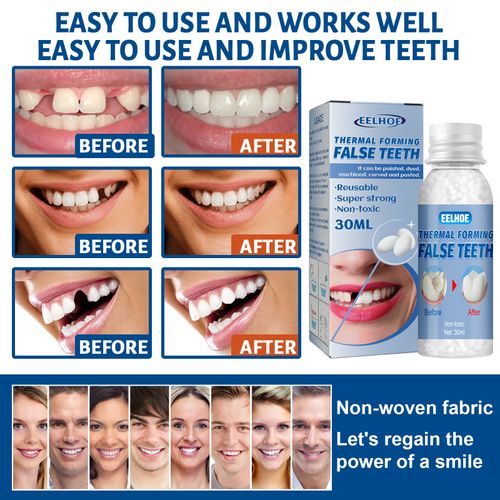 EELHOE Moldable Dental Gel Dentures Temporary Fillings Cavities ,Daily dental care, temporary resin denture, adhesive