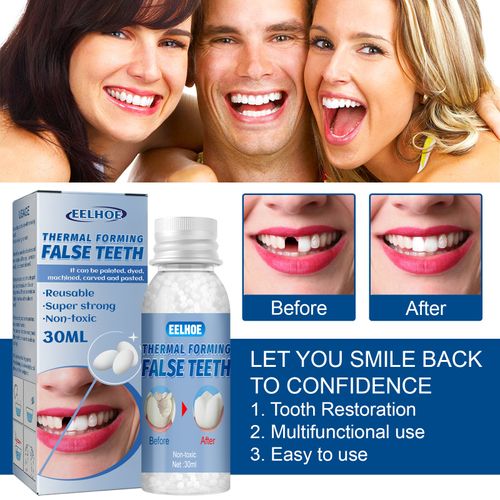 EELHOE Moldable Dental Gel Dentures Temporary Fillings Cavities ,Daily dental care, temporary resin denture, adhesive