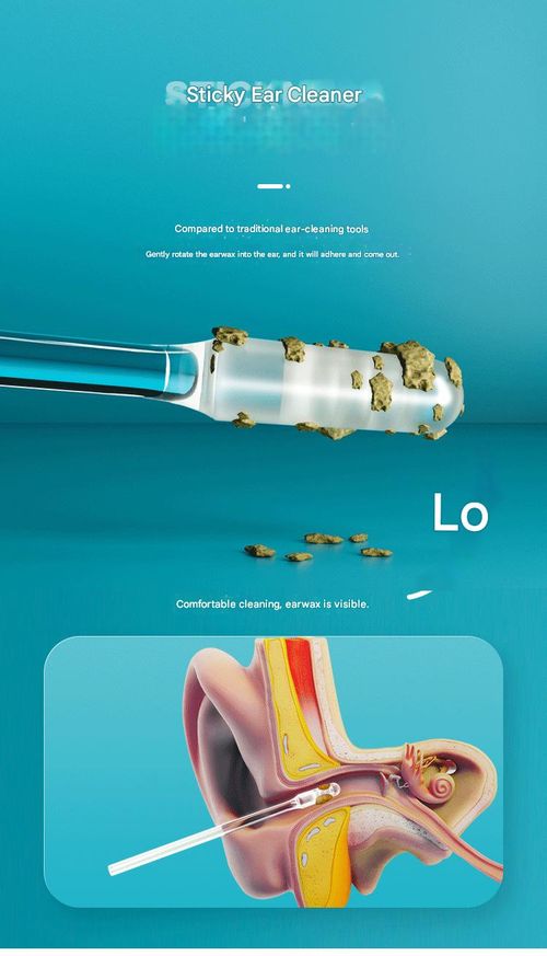 2026 New Model Sticky Ear Stick: An Adhesive Ear Cleaner. Crafted from eco-friendly resin, it is safe, hygienic, and effortlessly removes earwax.