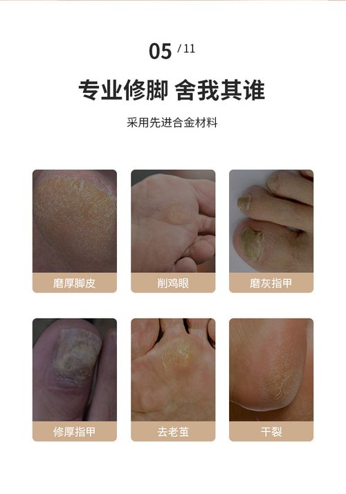 Electric Feet Callus Remover,Portable Electronic Foot FilePedicure Tools,Waterproof Foot Scrubber File,Pedi Foot Carefor Dead,Hard Cracked Dry Skin Manicure Nail Nail CareCutics Nail Art, holiday gifts rough adjustable foot file speed peel soft corn rasp