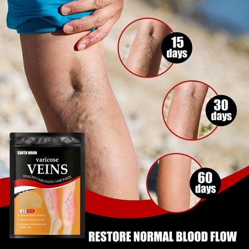 Varicose vein patches, relieve varicose vein blockage and protrusion, cold compress vein health care patches, leg care patches, 12 patches per pack.
