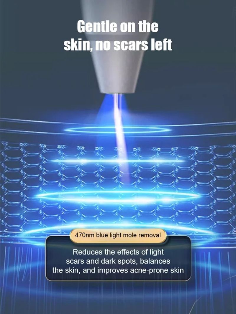 ⚡ Laser Painless Wart Removal Pen 🖊️