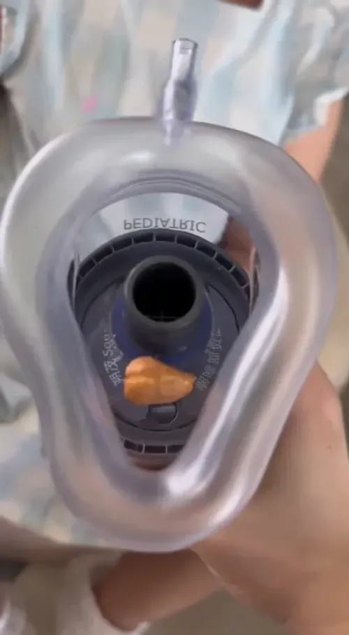 HomeHero Anti-Chock Device — Quickly clears airways when traditional methods fail, ensuring safety for all ages