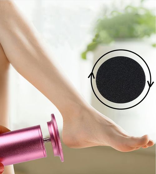🔥Electric Foot Callus Remover