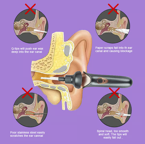 Painless ear cleaning for the whole family