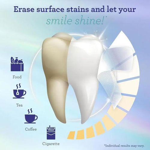 GuruNanda Whitening Strips