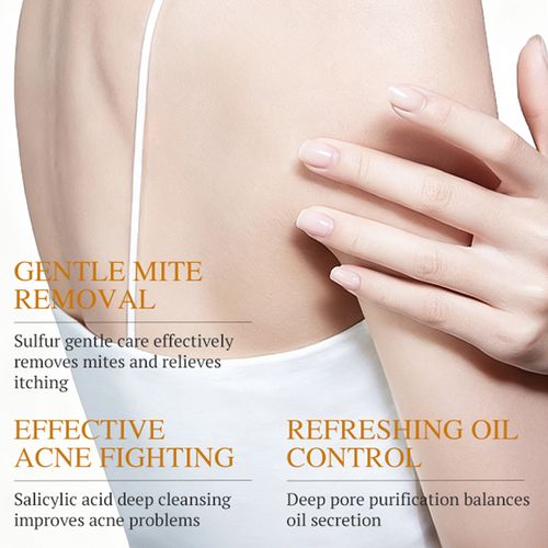 Sulfur Anti-Mite Soap: Antibacterial, Acne-Fighting, and Whitening Herbal Soap (3-Pack)