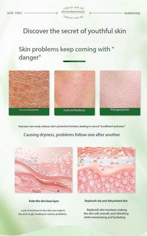 Kenya's Favorite Aloe Gel - Cool, Clear & Glow: For Sunburn, Acne & Daily Moisture