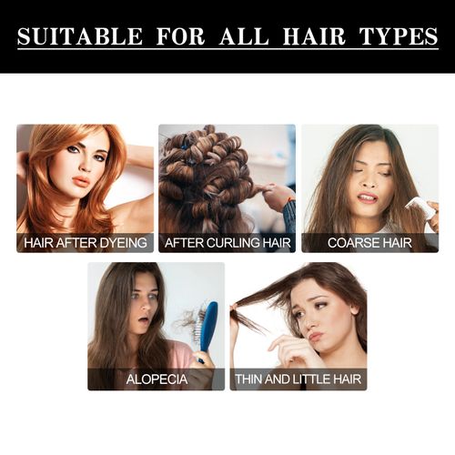 IMAGINE A VIDA SEM CALVÍCIES, BORDAS INVISÍVEIS, CABELOS RALOS E CABELOS ESTAGNADOS...