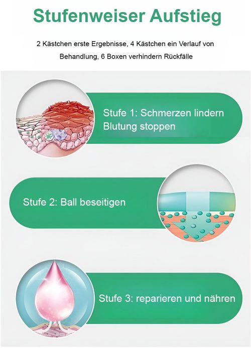 Spray de alívio anal adulto hemorroida quebrada