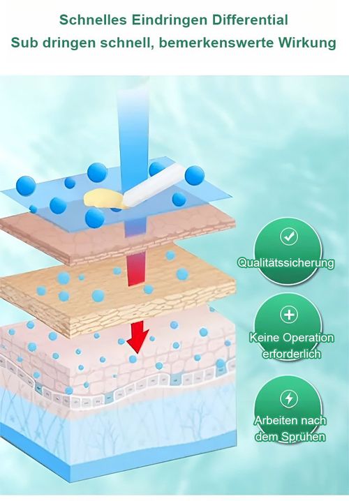 Spray de alívio anal adulto hemorroida quebrada