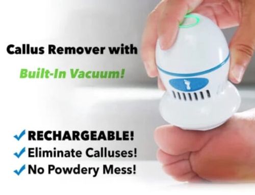 🔥HOT-SALE🔥 Novo Moedor de Pé Elétrico Pele Dura Ruptura Skin Trimmer Pele Mortod