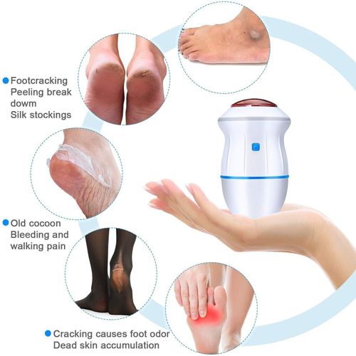 🔥HOT-SALE🔥 Novo Moedor de Pé Elétrico Pele Dura Ruptura Skin Trimmer Pele Mortod