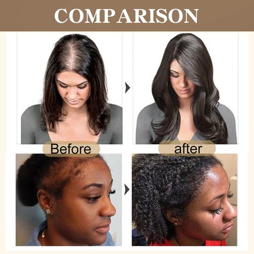 🌹Batana oleogenetic hair conditioner(desconto de 50% por tempo limitado)