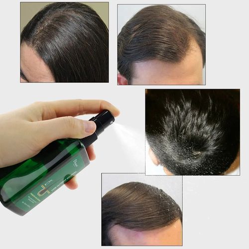 Spray de crescimento de cabelo (comprar 1 por tempo limitado, obter 1 grátis)