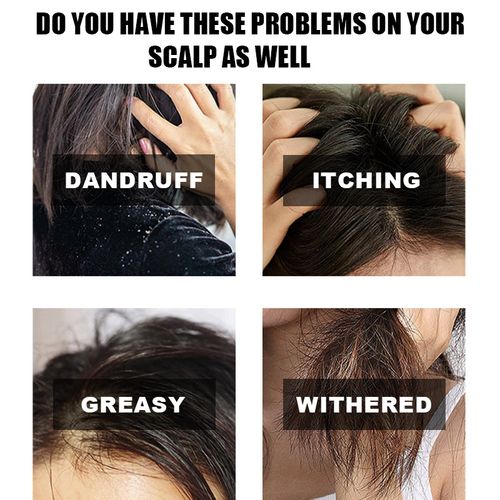 Batana oil shampoo condicionador set (desconto de 50% por tempo limitado