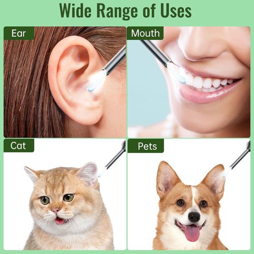 Ear Wax Removal Tool Camera 9-in-1 Ear Wax Removal Kit with 1920P Camera - Earwax Remover Tool with 6 Ear Spoons & LED Light - Ear Cleaner for iOS & Android - Safe Ear Canal Cleaning Set (Black)