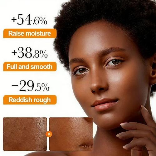 DR.DESS Turmeric Face Cream, Anti Oxidation Turmeric Cream For Deep Moisturizing skin Prevents Acnes, Oil Control and Soothing, skin Repair