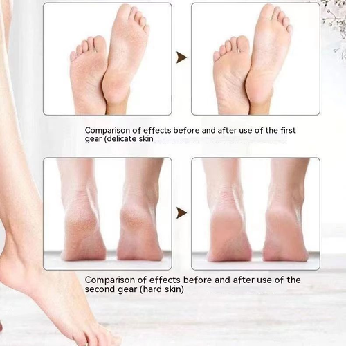 Electric Foot File
