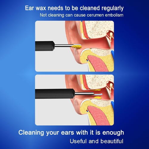 visual ear pick