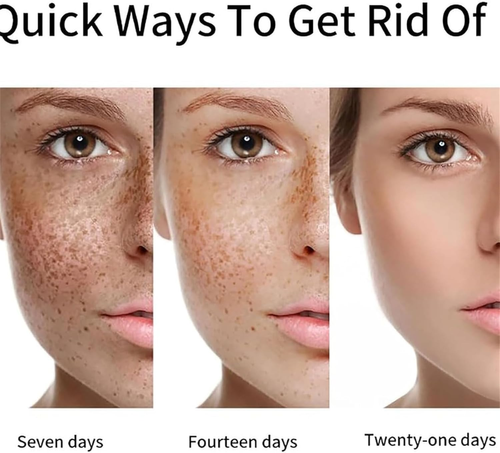 Whitening Essential Oil Niacinamide Anti-Ageing Serum Repair Skin, Dark Spot Corrector, Facial Hydrating Serum, Moisturising and Brightening, Anti Ageing Moisturiser for Skin Tightening (2