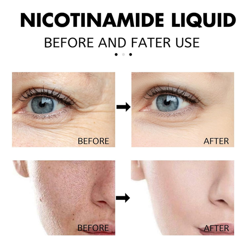 Whitening Essential Oil Niacinamide Anti-Ageing Serum Repair Skin, Dark Spot Corrector, Facial Hydrating Serum, Moisturising and Brightening, Anti Ageing Moisturiser for Skin Tightening (2