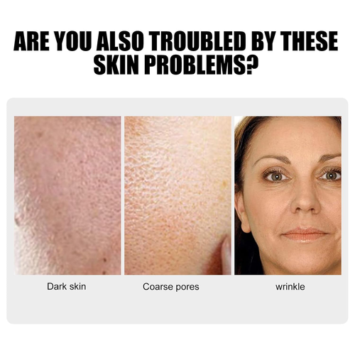 Whitening Essential Oil Niacinamide Anti-Ageing Serum Repair Skin, Dark Spot Corrector, Facial Hydrating Serum, Moisturising and Brightening, Anti Ageing Moisturiser for Skin Tightening (2