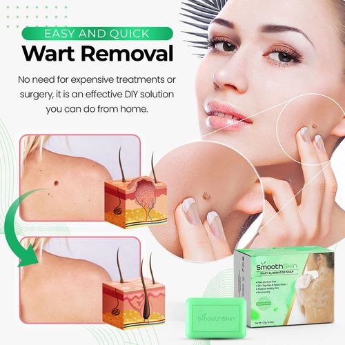 Sabonete Eliminador de Verruga SmoothSkin