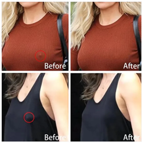 Silicone Nipple Covers
