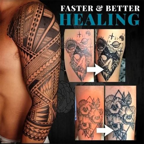 Tattoo Brightening