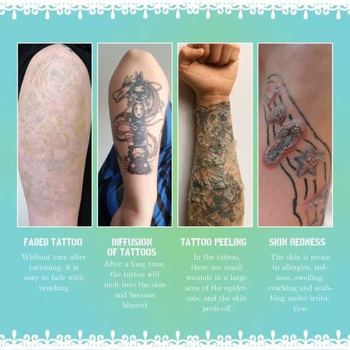 Tattoo Brightening