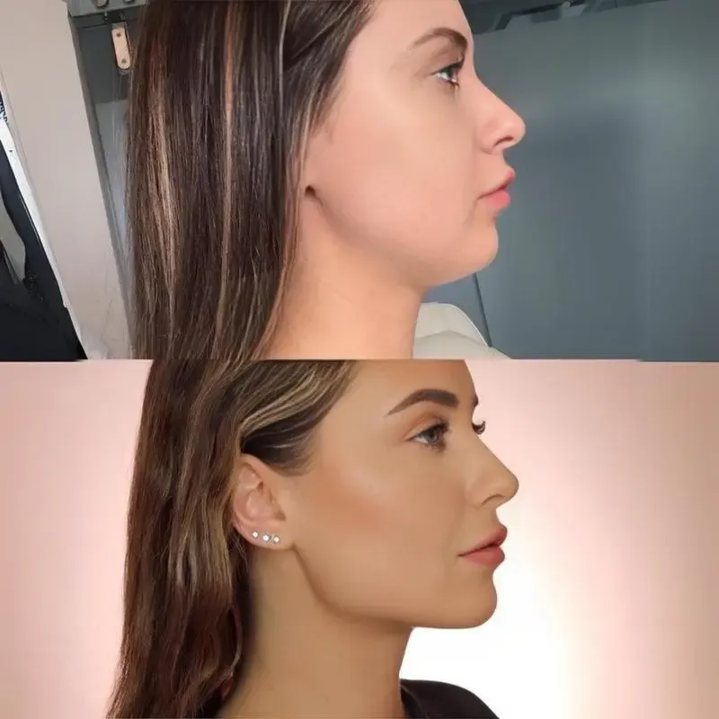 食用グレード 顎トレーニングボール｜HOLE-POWER 技術 4 レベル抵抗