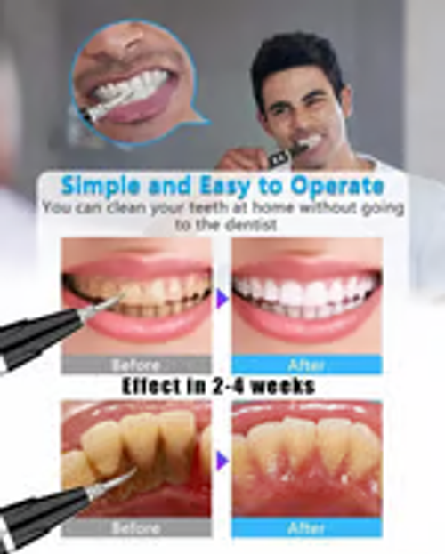 Electric Ultrasonic tooth cleaner