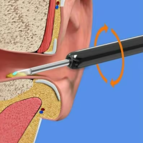 Visual Ear Pick Wireless Cleaning Endoscope HD Ear Pick  Children's ear scoop, ear scoop, wireless cleaning endoscope, high-definition ear picking