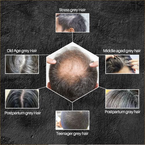 Men's Shampoo Bar for Turning Gray Hair Black