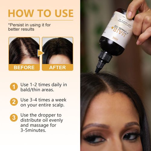 Óleo essencial para o cuidado do cabelo KOEC, óleo essencial nutritivo para o couro cabeludo, cuidado suave para o cabelo seco