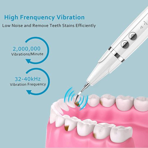 Produto de limpeza de dentes ultrassónico para limpar dentes amarelos, manchas de fumo e branquear os dentes