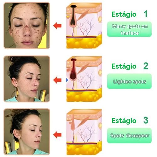 Purifying Exfoliating Gel - Gel Exfoliante Purificante, Limpeza Profunda, Pele Suave, Remove Células Mortas